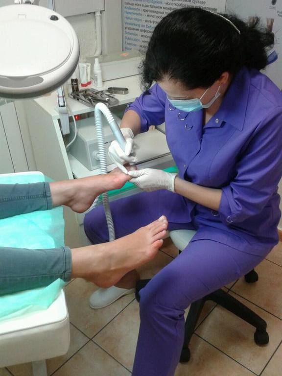 Услуги подолога в Хмельницком - изображениe 1