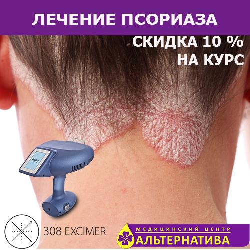Лечение псориазаЭксимер лазер 380 нм - изображениe 5
