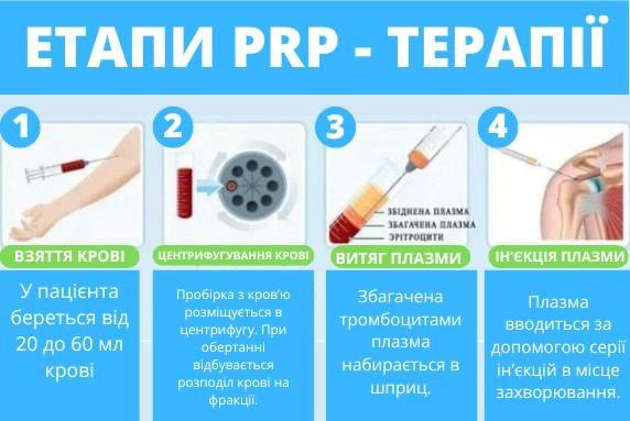 Косметологія Плазмотерапія PRPPPP - изображениe 5